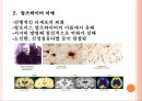 [치매] 치매 개념, 치매 종류, 치매 증상, 치매 예방법 및 치료법 6페이지