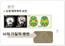 [정신분열증의 음악치료] 정신분열증 원인과 정신분열증 증상, 정신분열증 음악치료 방법 10페이지