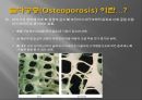[골다공증骨多孔症] 골다공증 개념, 골다공증 원인, 골다공증 문제, 골다공증 증상, 골다공증 예방법 3페이지