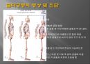 [골다공증骨多孔症] 골다공증 개념, 골다공증 원인, 골다공증 문제, 골다공증 증상, 골다공증 예방법 7페이지