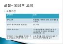 [연부조직, 뼈, 그리고 수술 후 상태에서 치료의 원리] 연부조직 병변, 급성기 동안의 관리, 누적외성, 관절 외상 후 고정 등.pptx 29페이지