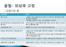 [연부조직, 뼈, 그리고 수술 후 상태에서 치료의 원리] 연부조직 병변, 급성기 동안의 관리, 누적외성, 관절 외상 후 고정 등.pptx 31페이지
