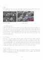 간암 케이스 스터디 casestudy - 간세포 암종 (Hepatocellular Carcinoma) 사례연구 : Dx : Multiple HCC with rupture 8페이지