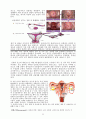 여성생식보고서 - 여성생식기계 The reproductive systems {여성 생식기계 구조, 월경주기, 여성의 임신, 폐경기, 여성생식기계 질병} 8페이지