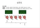심전도 (심전도 분석, 부정맥).pptx 4페이지