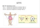 심전도 (심전도 분석, 부정맥).pptx 5페이지