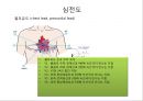 심전도 (심전도 분석, 부정맥).pptx 7페이지