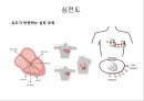 심전도 (심전도 분석, 부정맥).pptx 8페이지