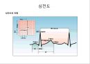 심전도 (심전도 분석, 부정맥).pptx 10페이지