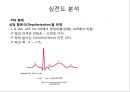 심전도 (심전도 분석, 부정맥).pptx 12페이지