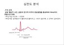 심전도 (심전도 분석, 부정맥).pptx 13페이지
