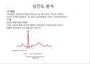 심전도 (심전도 분석, 부정맥).pptx 15페이지