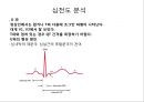 심전도 (심전도 분석, 부정맥).pptx 16페이지