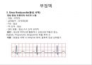 심전도 (심전도 분석, 부정맥).pptx 21페이지