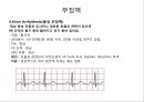 심전도 (심전도 분석, 부정맥).pptx 22페이지
