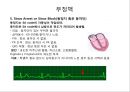 심전도 (심전도 분석, 부정맥).pptx 23페이지