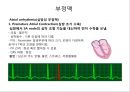 심전도 (심전도 분석, 부정맥).pptx 24페이지