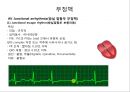 심전도 (심전도 분석, 부정맥).pptx 28페이지