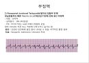 심전도 (심전도 분석, 부정맥).pptx 29페이지