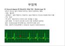 심전도 (심전도 분석, 부정맥).pptx 32페이지