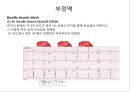 심전도 (심전도 분석, 부정맥).pptx 34페이지