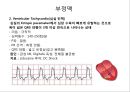 심전도 (심전도 분석, 부정맥).pptx 38페이지