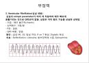 심전도 (심전도 분석, 부정맥).pptx 39페이지