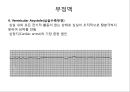 심전도 (심전도 분석, 부정맥).pptx 40페이지