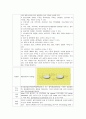 성인간호학 Case study-빈맥서맥 증후군 21페이지