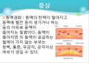 고지혈증 16페이지