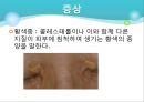 고지혈증 18페이지