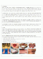 가와사키(kawasaki disease) Case study 실습성적 A+ 3페이지