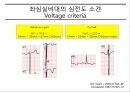 CHF 케이스(심부전 케이스) 33페이지