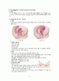 모성간호학 case study/산후출혈 간호과정/산후출혈 문헌고찰/산후출혈 간호진단/제왕절개 문헌고찰/제왕절개 간호과정/c-sec/교수님께서 top3안에 뽑은 최신자료 3페이지