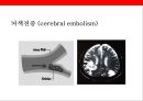 뇌 • 심혈관계질환의 이해 및 예방 12페이지