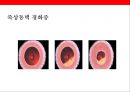 뇌 • 심혈관계질환의 이해 및 예방 13페이지