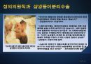 과학생명윤리,샴쌍둥이,샴의의의 유래 태어나는 이유,의학적측면,샴의 딜레마,자율성 존중의 원칙 17페이지