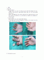 절단 케이스 Amputation 3페이지