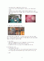 절단 케이스 Amputation 4페이지