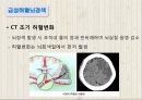 뇌졸중에 대하여 8페이지
