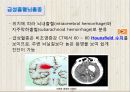 뇌졸중에 대하여 13페이지