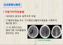 뇌졸중에 대하여 16페이지