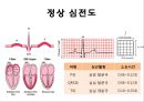 심전도 15페이지
