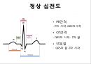심전도 16페이지