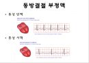 심전도 18페이지