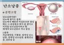 부인과 간호과정 자료입니다 -- 난소낭종 case study ( A+ 받았습니다.) 2페이지