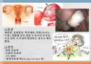 부인과 간호과정 자료입니다 -- 난소낭종 case study ( A+ 받았습니다.) 3페이지
