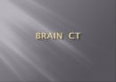 Brain CT에 관한 PPT 1페이지