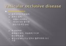Brain CT에 관한 PPT 2페이지