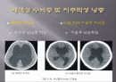 Brain CT에 관한 PPT 4페이지